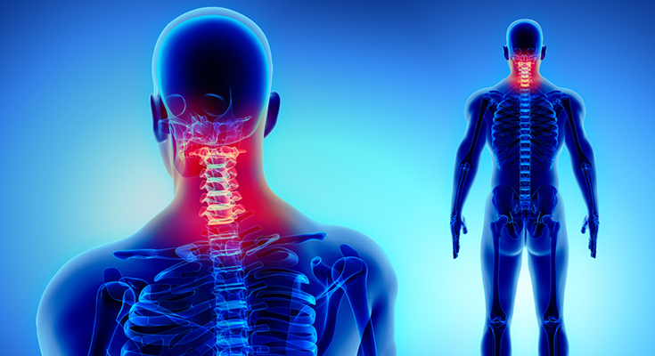 What Is Cervical Pain Causes Symptoms And Treatment
